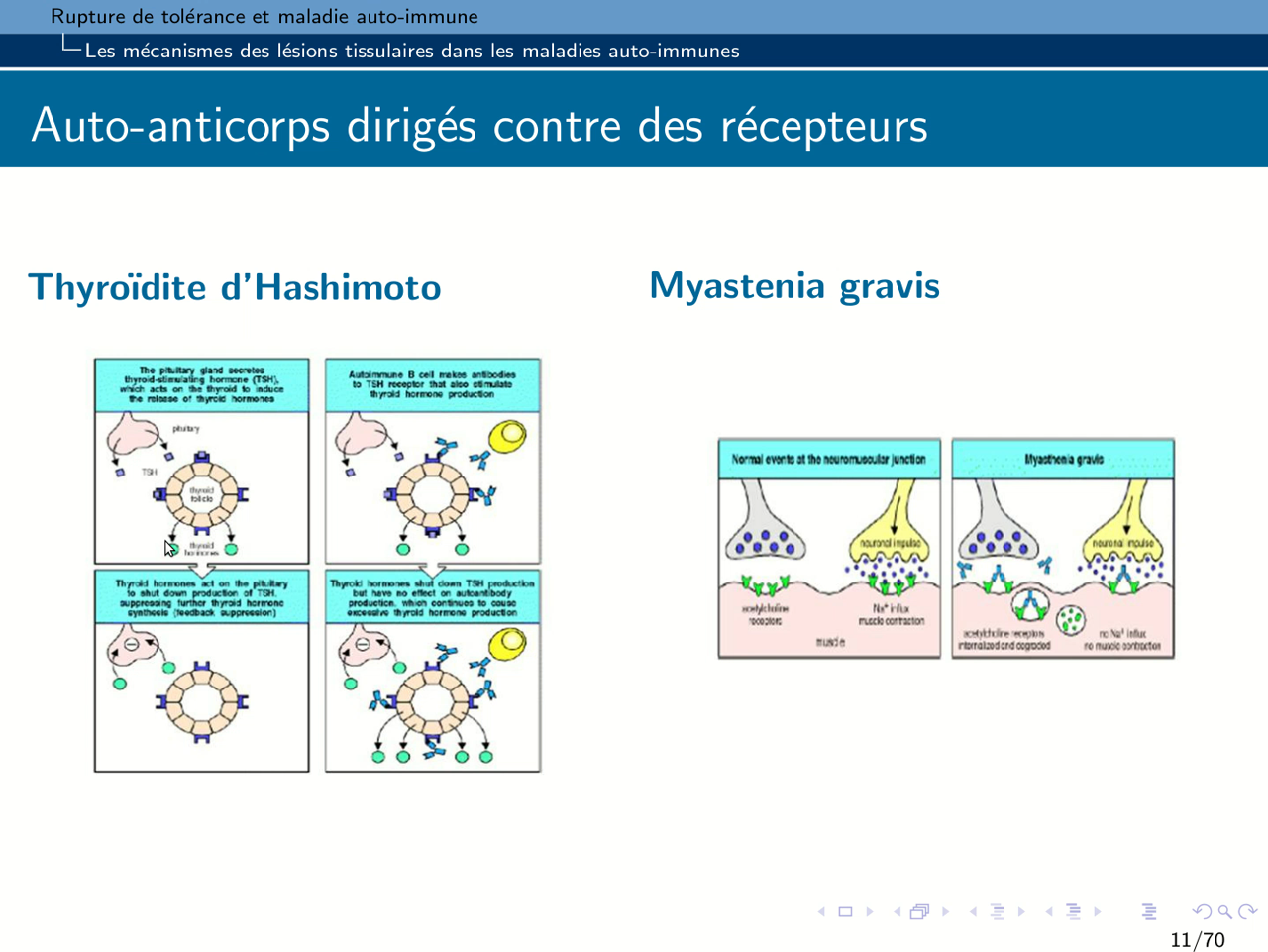 UTLN.Pod - B67 - Cahpitre 3 - Les Maladies Auto-Immunes